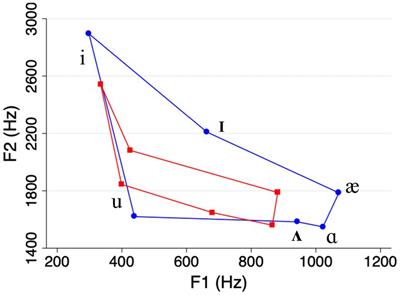 The role of speech style, frequency, and density in recognition memory for spoken words